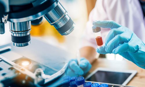 Labormitarbeiter am Mikroskop mit Blutprobe